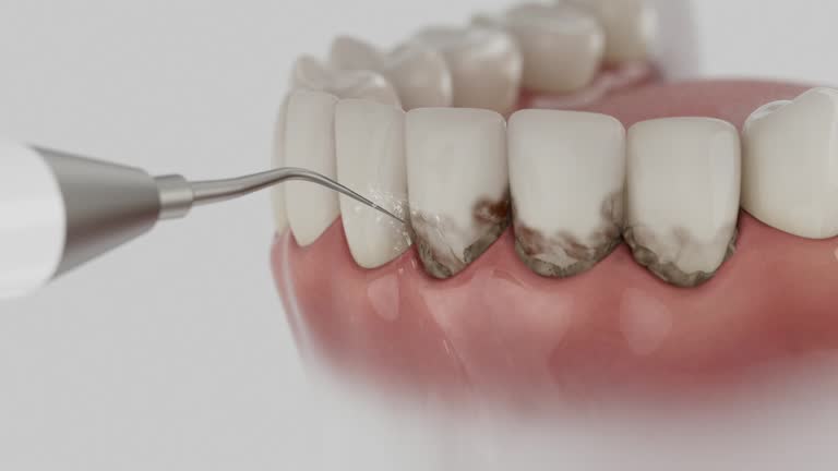 Reliable Tooth Extraction contractor in Le Grand, CA by Smile Center Dentistry
